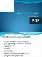 Choriocarcinoma