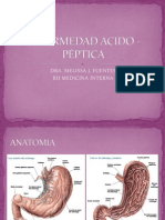 Enfermedad Acido - Péptica