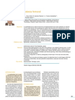 Epifisiolisis Cabeza Femoral