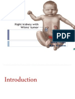 Nephroblastoma..ppt