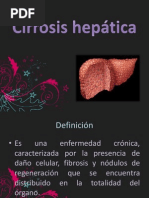 Cirrosis Hepática PDF