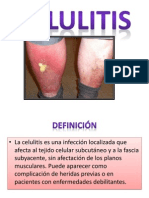 Celulitis