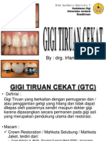 Gigi Tiruan Cekat