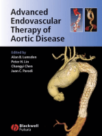 Advanced Endovascular Therapy of Aortic Disease