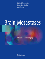 Brain Metastases: Advanced Neuroimaging