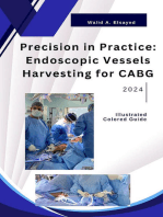 Precision in Practice: Endoscopic Vessel Harvesting for CABG