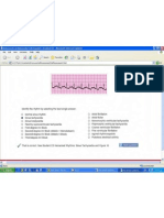 ACLS Precourse Test Answers