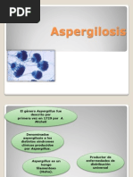 Aspergilosis Hoy