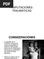 Amputaciones Traumaticas