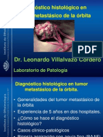 Diagnostico Histologico de Tumor Metastasico de Orbita