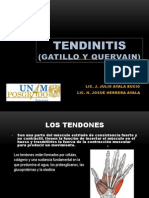 Tendinitis