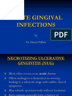 6 Acute Gingival Infections