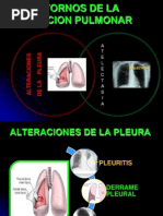 Trastornos de Insuflacion