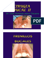 8 Frenillos Bucales