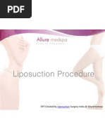 Liposuction - Sculpt and Shape Your Body.