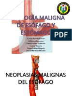 Patologia Maligna Esofago