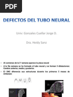 JDGC Defecto Tubo Neural