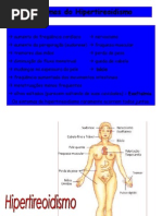 Hiper Sintomas e Hipotireoidismo