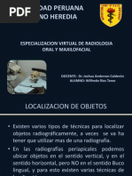 Tecnica de Localización