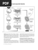 Pathophysiology of Myocardial Infarction