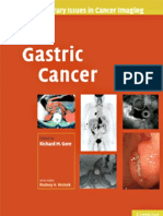 Gastric Cancer