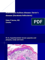 Acantholytic Bullous Disease (Darier's Disease, Keratosis Follicularis)