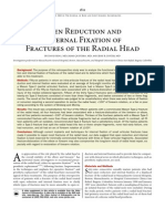 Open Reduction and Internal Fixation of Fractures of The Radial Head