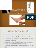 All About Fracture