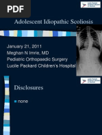 Scoliosis