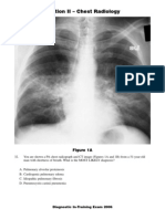 Section II - Chest Radiology: Figure 1A