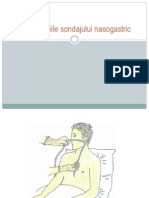 Complicatiile Sondajului Nasogastric