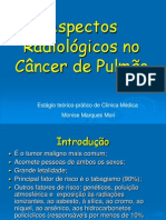 Cancer Pulmão