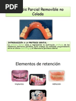 Prótesis Parcial Removible No Colada