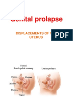 Genital Prolapse