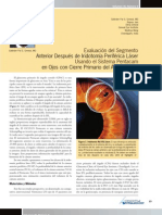 Evaluacion de Patologias Del Segmento Despues de Iridotomia Periferica Laser Usando El Sitema Pentacam