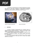 Tomografia Helicoidal