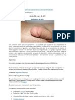 Angioedema Del P