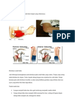 Dislokasi Sendi