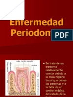 Enfermedad Periodontal