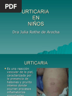 Urticaria en Ninos