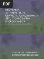 Neoplasia Intraepitelial Cervical, Carcinoma in Situ y