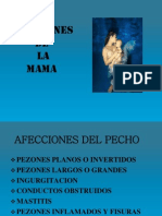 Afecciones de La Mama Extraccion Manual