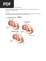 Stages of Labor Nursing Considerations