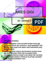 Karies Gigi