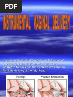 50-Instrumental Vaginal Delivery