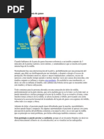 Tendinitis de La Pata de Ganso