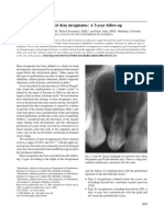 Endodontic Treatment of Dens Invaginatus