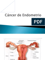 Cancer de Endometrio Titulacion 2013