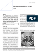 Empty Nose Syndrome Post Radical Turbinate Surgery: Case Report