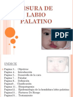 Labio Leporino